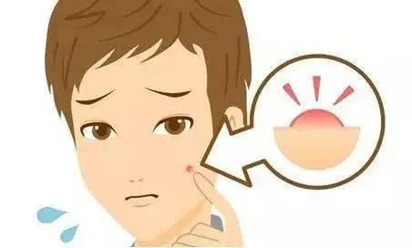 痤疮发病都是什么内在原因以及生活如何护理好呢?